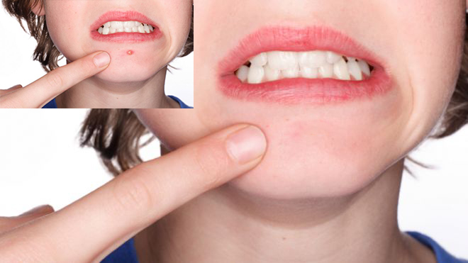 will I Will Re-touch Your Photos in Photoshop: Zits, Blemishes and Wrinkles and Color Correct